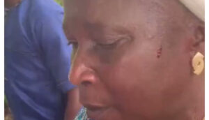 The injured Ondo Women Affairs Commissioner